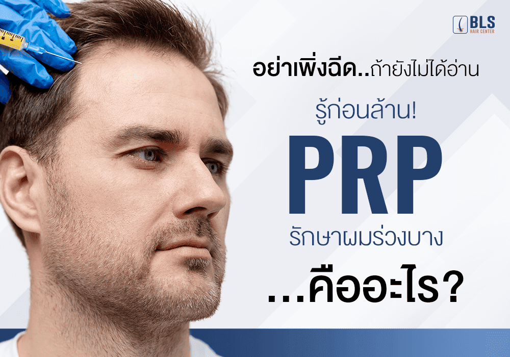 อย่าเพิ่งฉีดถ้ายังไม่ได้อ่าน รู้ก่อนล้าน! PRP รักษาผมร่วงบาง คืออะไร?