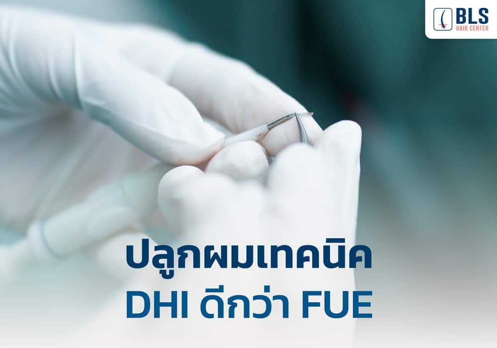 ปลูกผมเทคนิค DHI ดีกว่า FUE