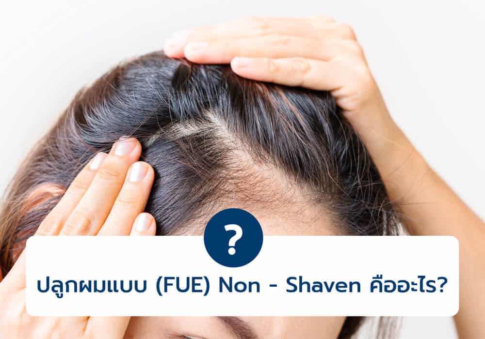 ปลูกผมเทคนิค(FUE) Non Shaven คืออะไร?