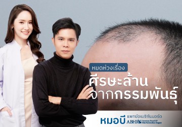 หมดห่วงเรื่อง หัวล้านกรรมพันธุ์