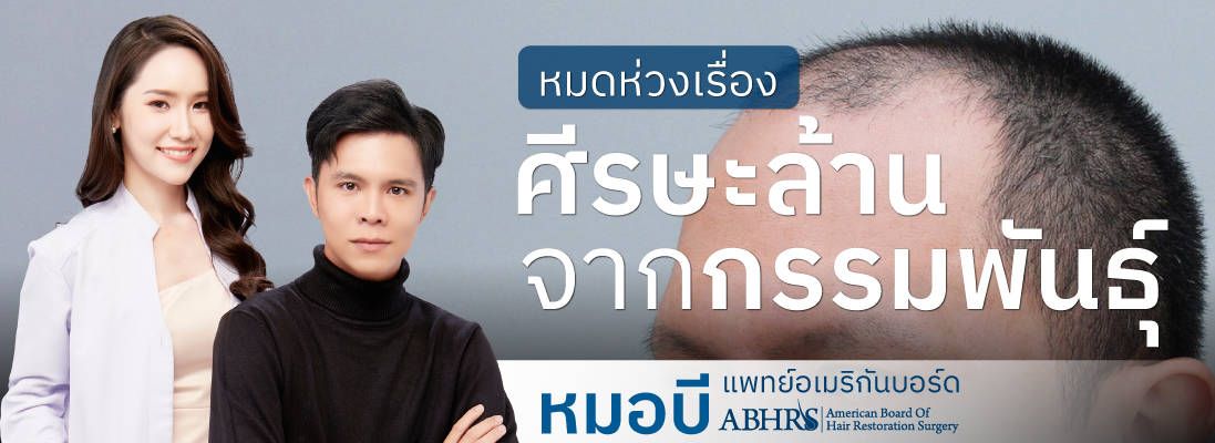 หมดห่วงเรื่อง หัวล้านกรรมพันธุ์