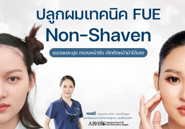 ปลูกไรผม ด้วยเทคนิค Non-Shaven FUE แนวผมละมุน กรอบหน้าชัด เลิกตัดหน้าม้าได้เลย