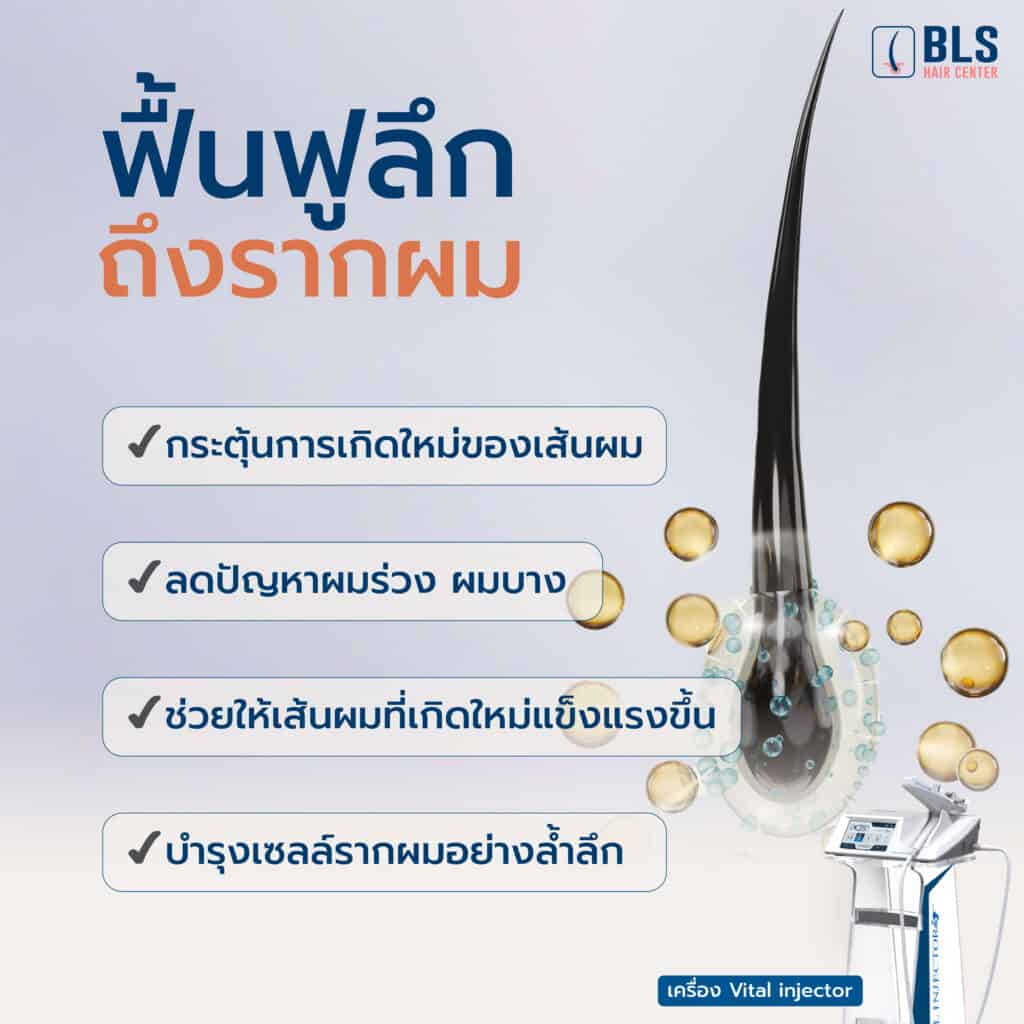 PRP ผม ฟื้นฟูลึกถึงรากผม