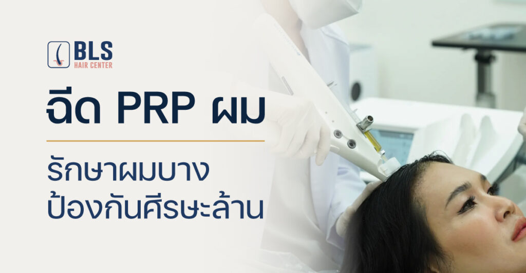 ฉีด PRP ผม รักษาผมบาง ป้องกันศีรษะล้าน