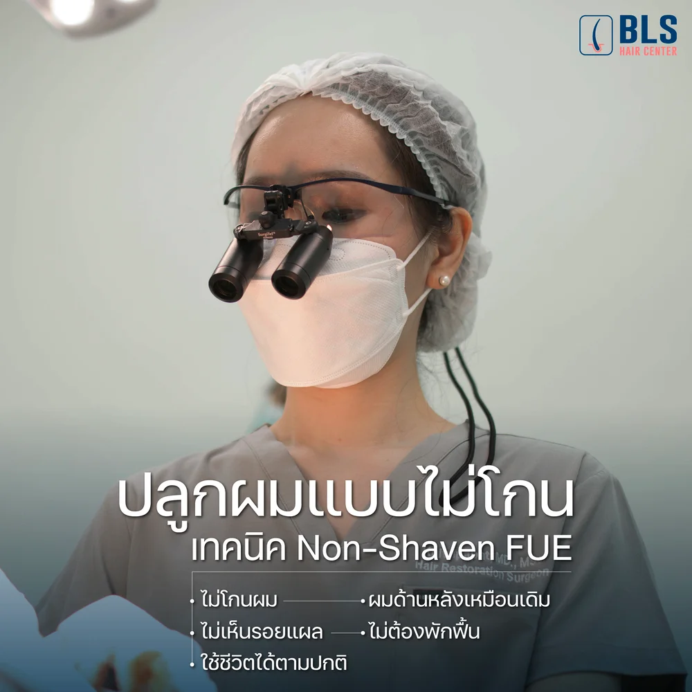 ข้อดีของการปลูกผมแบบไม่โกน (Non Shaven FUE) 