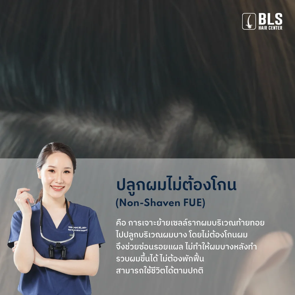 ปลูกผมไม่ต้องโกน (Non-Shaven FUE) คืออะไร?