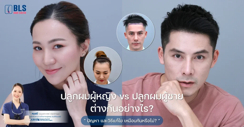 ปลูกผมผู้หญิง vs ปลูกผมผู้ชาย ต่างกันอย่างไร?