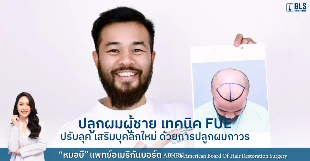 ปลูกผม FUE ปรับลุค เสริมบุคลิกใหม่ ด้วยการปลูกผมถาวร