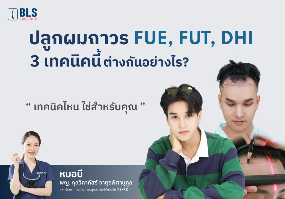 ปลูกผมถาวร แต่ละเทคนิค FUE FUT DHI ต่างกันอย่างไร?