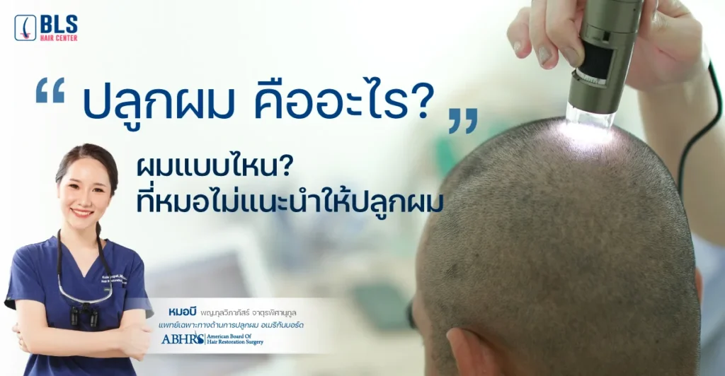 ปลูกผม คืออะไร? ผมแบบไหน? ที่หมอไม่แนะนำให้ปลูกผม