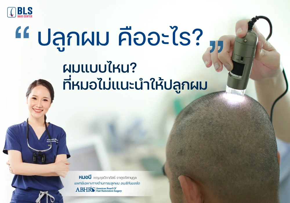 ปลูกผม คืออะไร? ผมแบบไหน? ที่หมอไม่แนะนำให้ปลูกผม