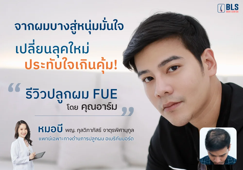 จากผมบางสู่หนุ่มมั่นใจ รีวิวปลูกผม FUE โดย คุณอาร์ม