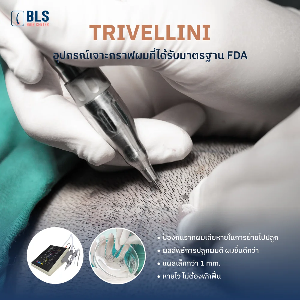 เครื่องเจาะกราฟผมไฟฟ้า Trivellini