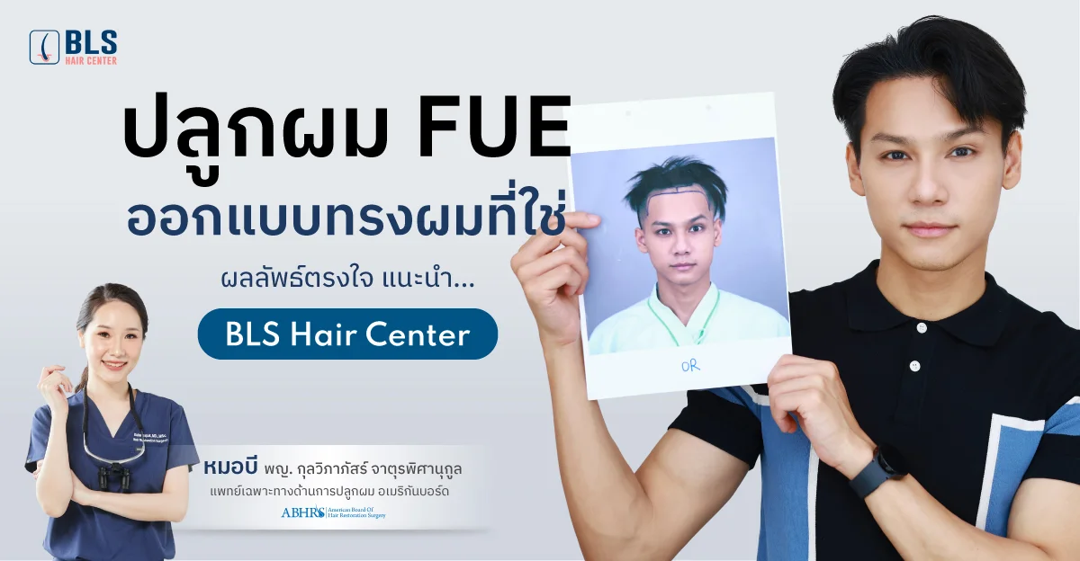 รีวิวปลูกผมถาวร