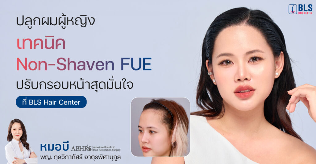  รีวิวปลูกผมผู้หญิง แบบไม่ต้องโกน | ปลูกผมผู้หญิง เทคนิค Non-Shaven FUE ปรับกรอบหน้า 