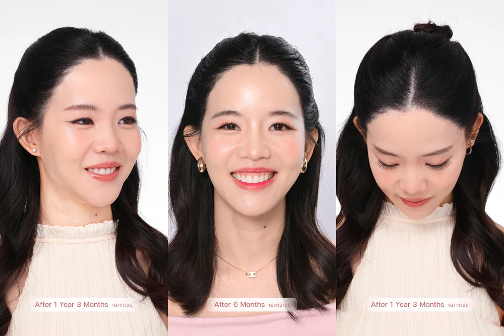 รีวิวคลินิกปลูกผมสำหรับผู้หญิงในไทย