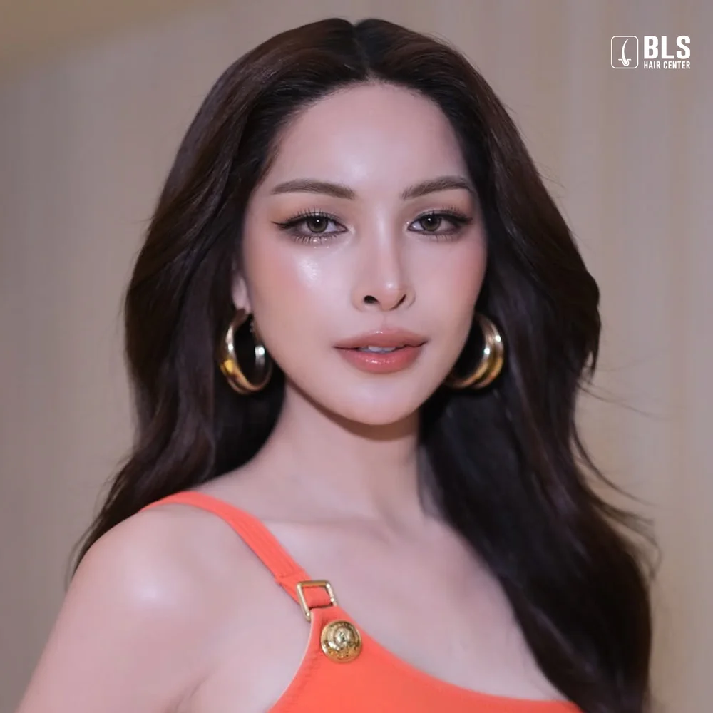ปลูกผมปรับกรอบหน้าช่วยอะไรได้บ้าง ผมบาง กลับมาหนา กรอบหน้าละมุน