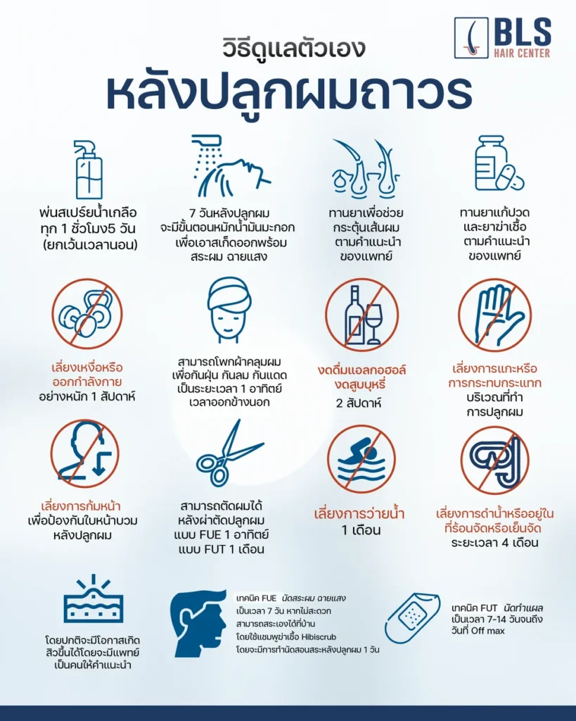 วิธีดูแลตัวเองหลังปลูกผม