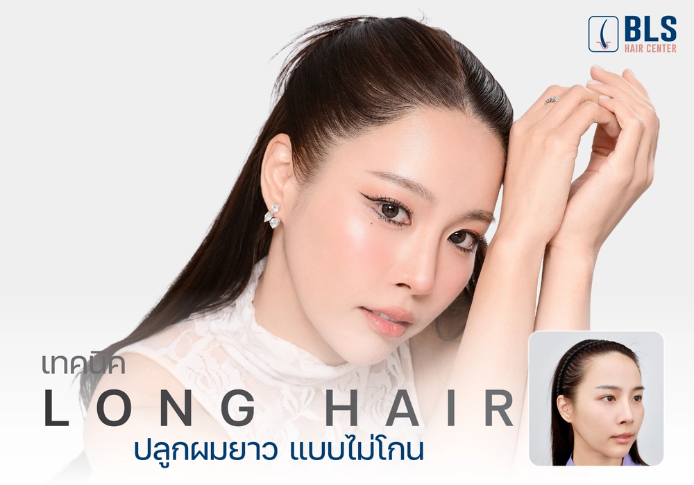 ปลูกผมยาว (Long Hair) ผมยาวทันใจ มั่นใจทันที ไม่มีแผลให้เห็น