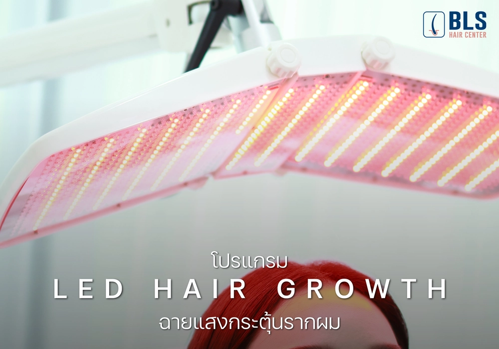 ฉายแสงกระตุ้นรากผม (LED Hair Growth)