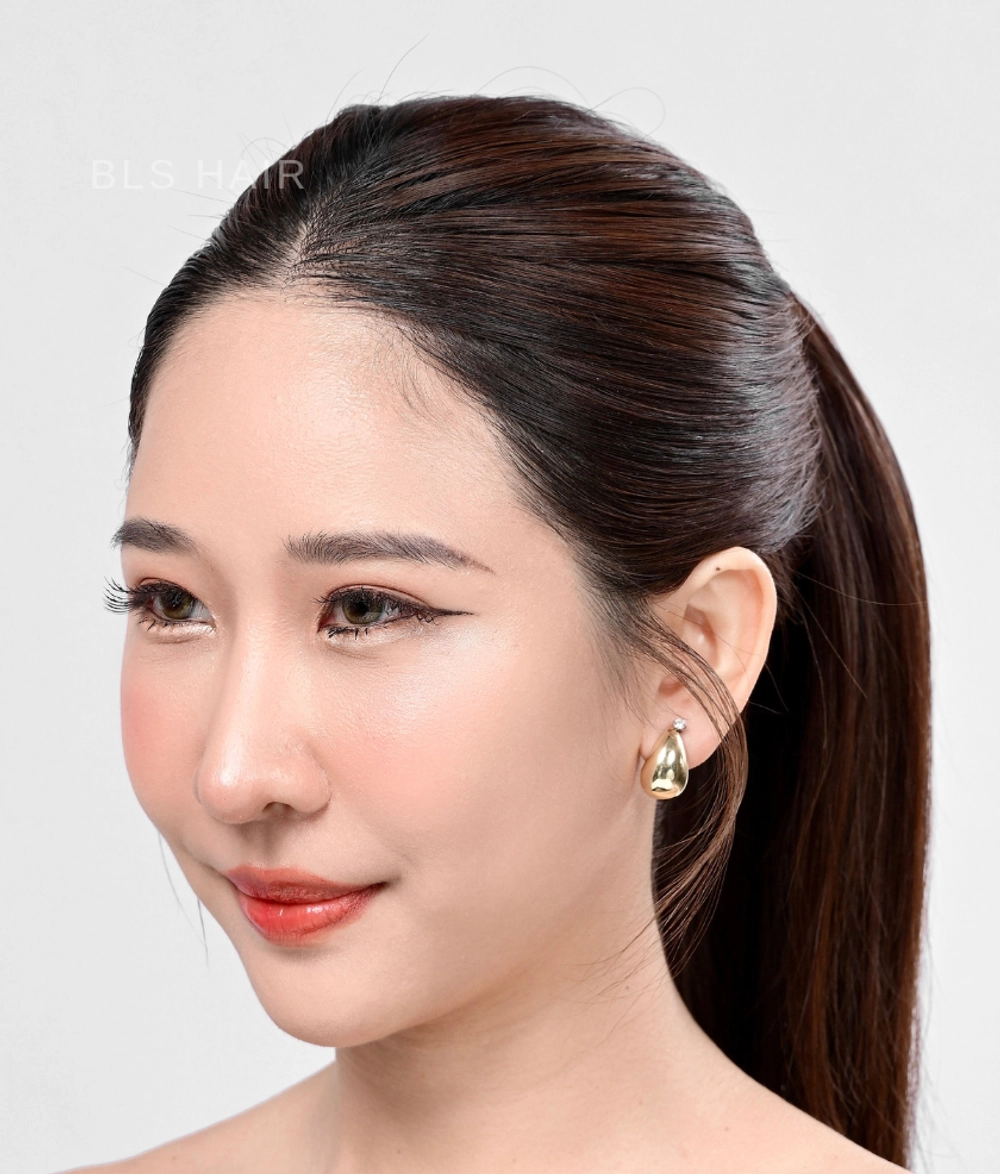 ปลูกผมไม่ต้องโกน Non Shaven FUE ผมเรียงเส้นสวย ไร้รอยแผล