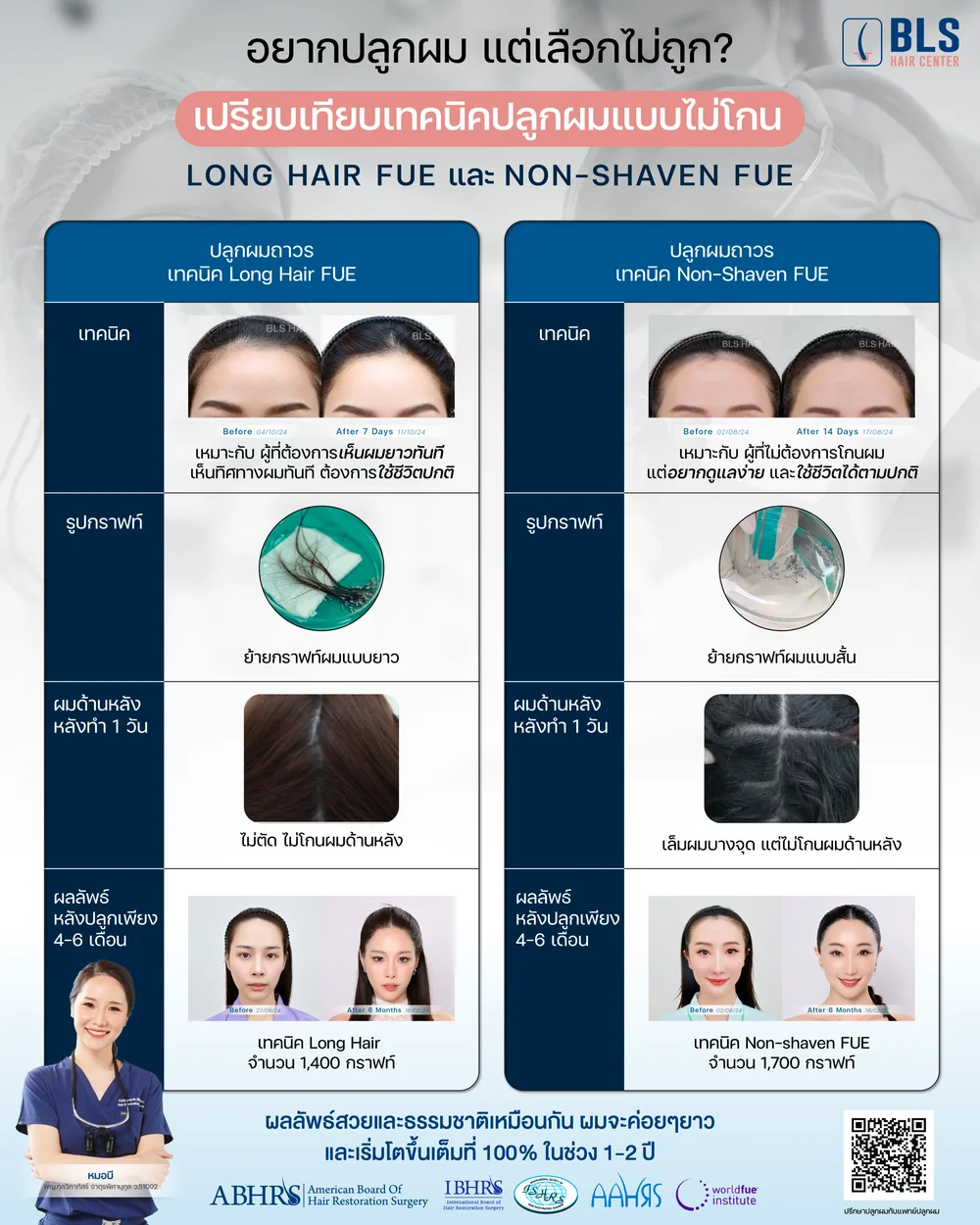 เปรียบเทียบเทคนิคปลูกผมแบบไม่โกน