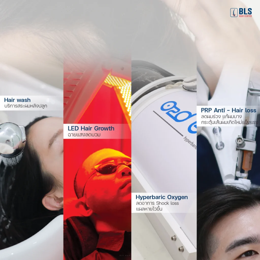 โปรแกรมดูแลหลังปลูกผม ที่ BLS Hair Center