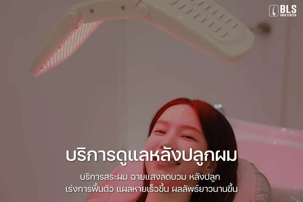 หลังปลูกผม คนไข้สามารถกลับไปพักฟื้นที่บ้านได้ทันที โดยแพทย์จะให้ยาและคำแนะนำที่ชัดเจน เพื่อให้การฟื้นตัวเป็นไปอย่างปลอดภัยและรวดเร็ว หลังจากนั้นแพทย์จะนัดติดตามผลที่คลินิกเป็นระยะ คนไข้สามารถรับบริการดูแลหลังปลูกผม ด้วยโปรแกรมเพื่อการฟื้นตัว ดูแลกราฟผมหลังปลูก และการวางแผนดูแลเส้นผมระยะยาว ช่วยให้ผลลัพธ์ของการปลูกผมอยู่ได้ยาวนานยิ่งขึ้น ที่ BLS Hair Center