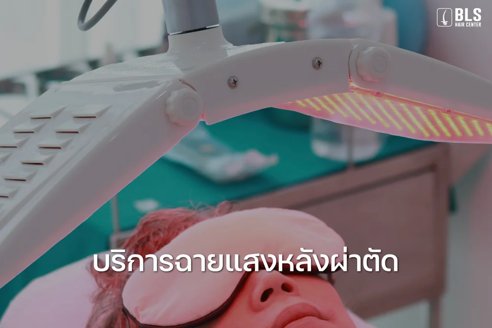 บริการฉายแสง (โปรแกรม LED Hair Growth)