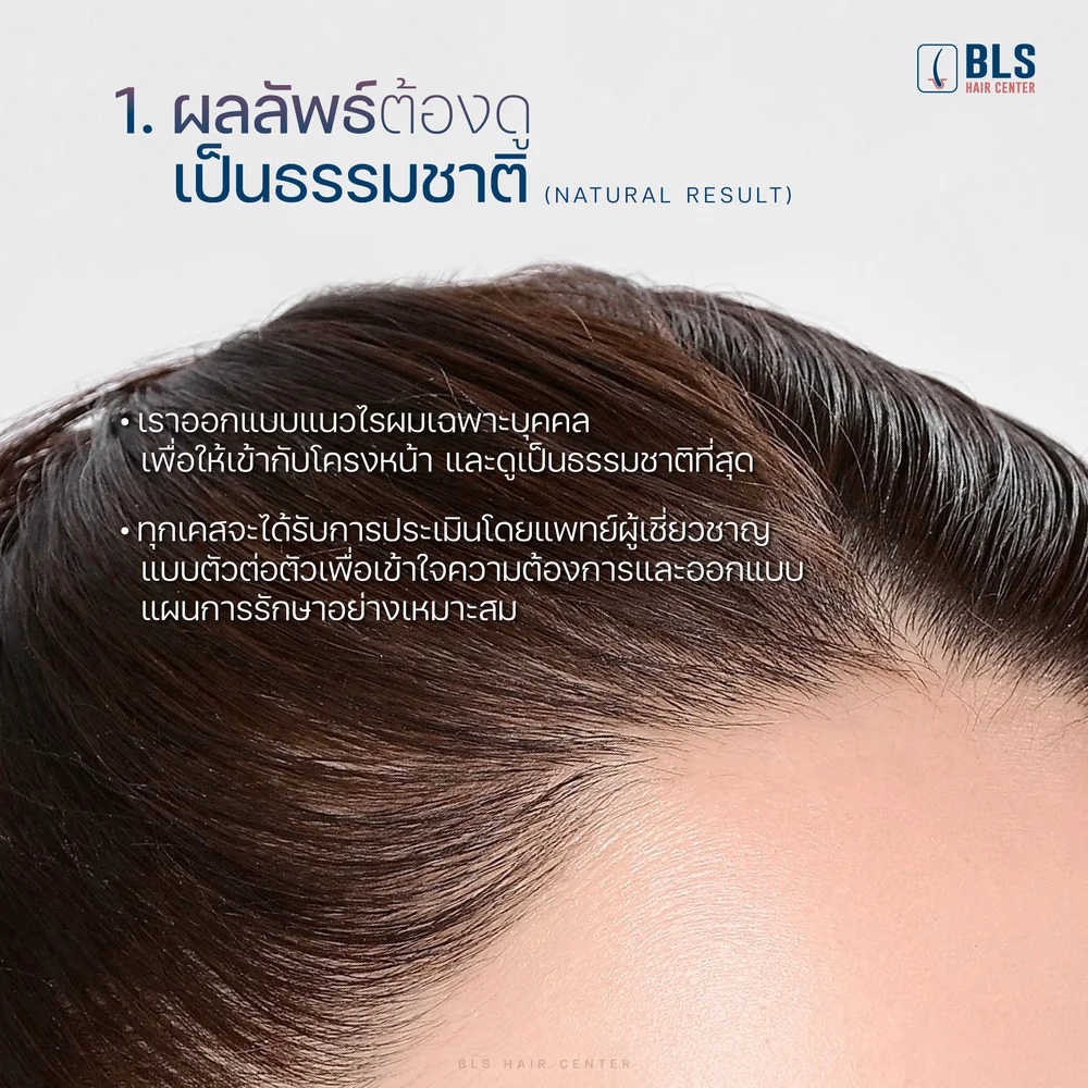 เทคนิคพิเศษที่เน้นแนวผมละมุน ดูเป็นธรรมชาติ (BLS Hairline)