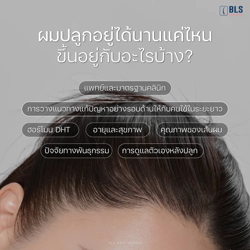ปลูกผมอยู่ได้นานไหม ขึ้นกับอะไรบ้าง