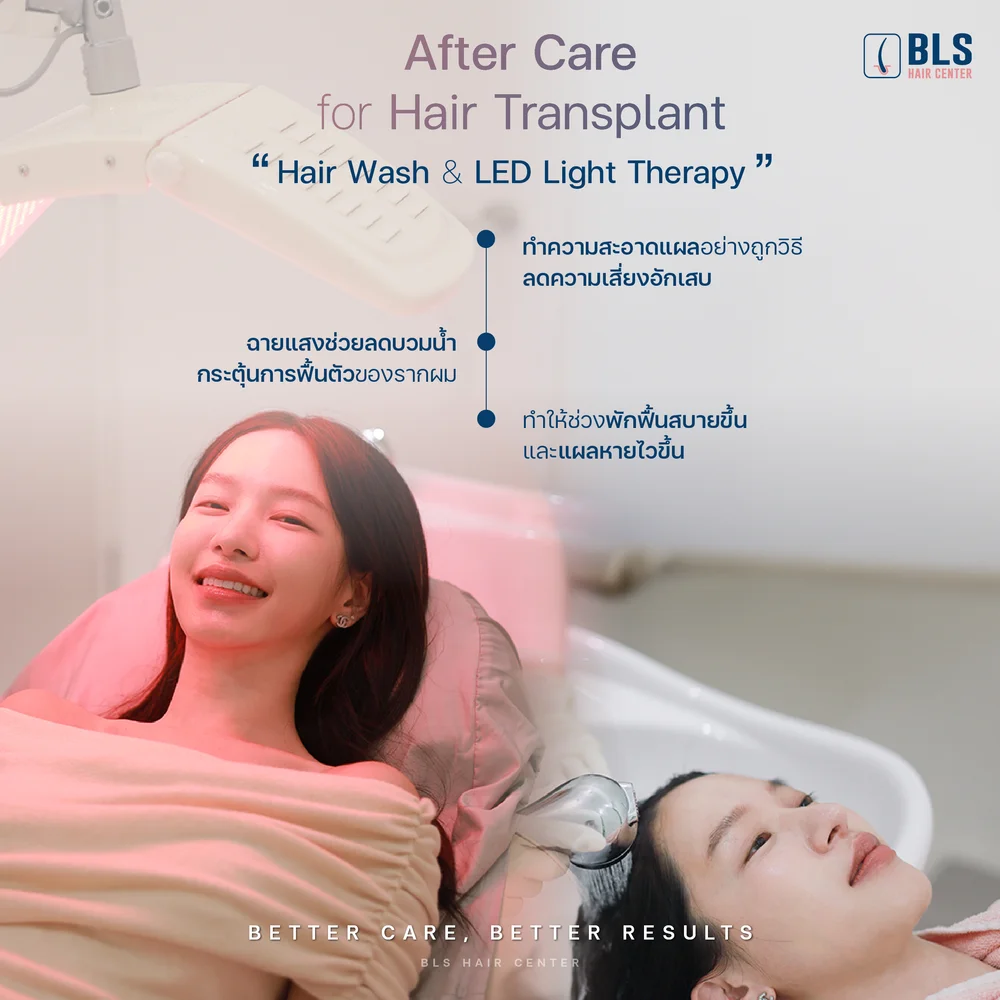 โปรแกรม LED Hair Growth ลดอาการบวม