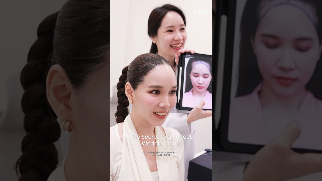 รวมวิดีโอรีวิวปลูกผม