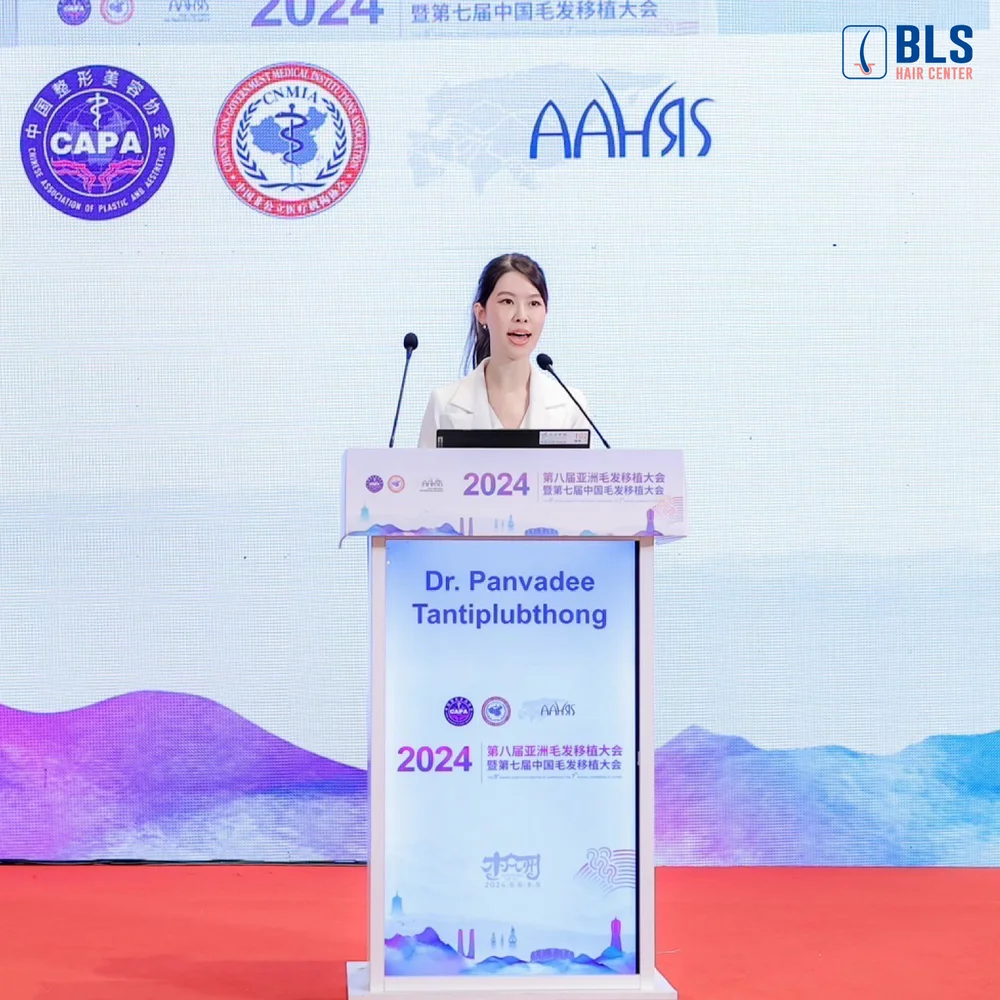 หมอพิ้งค์ ได้รับเกียรติเป็น Speaker ในงานประชุมวิชาการของแพทย์ปลูกผมเอเชีย 2024 ประเทศจีน
