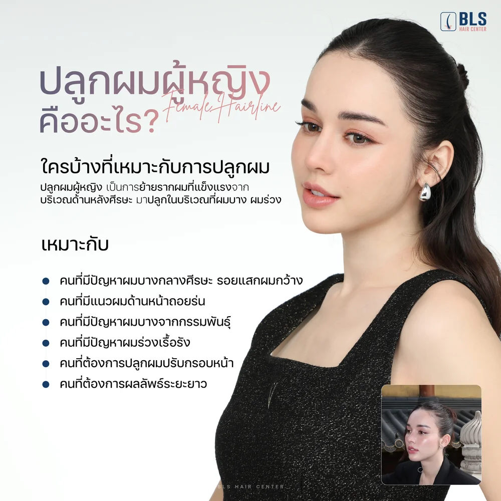 คลินิกปลูกผมที่มีรีวิวดีในไทยมีที่ไหนบ้าง
