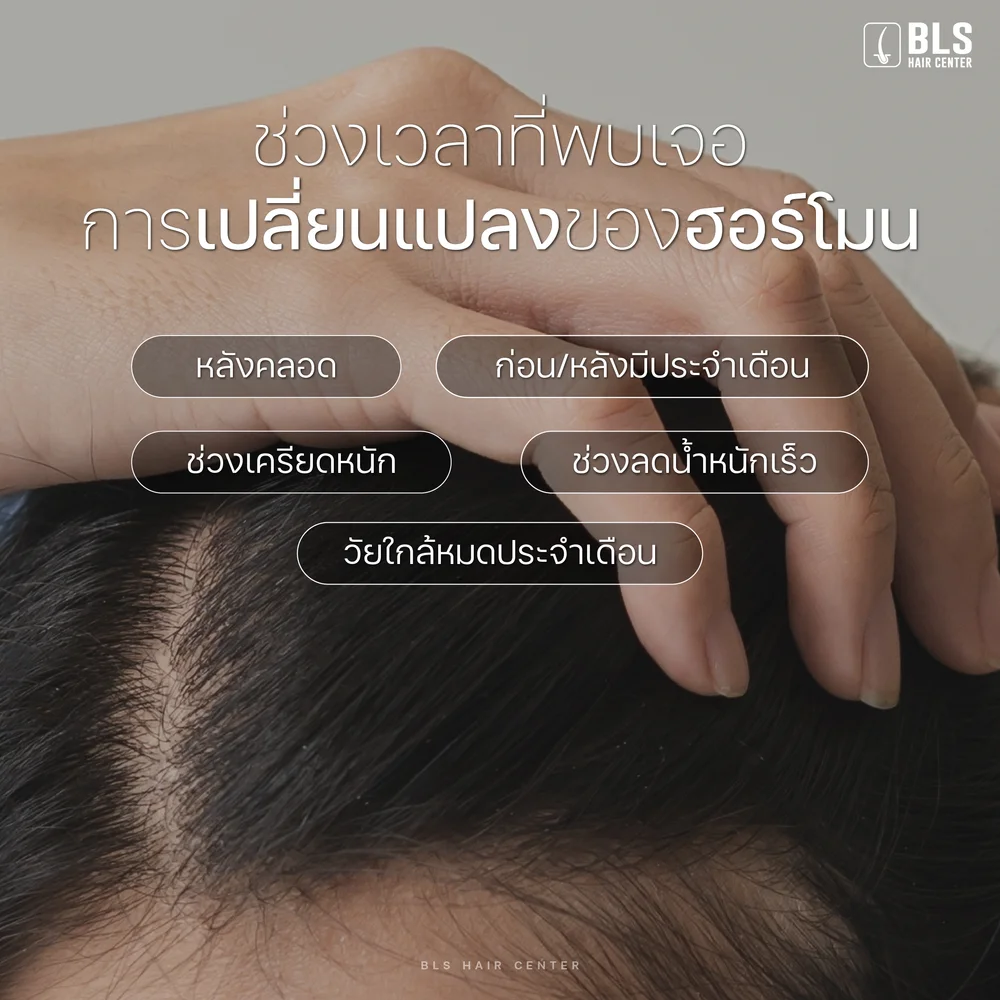 ปลูกผมผู้หญิง ที่ไหนดีในกรุงเทพ