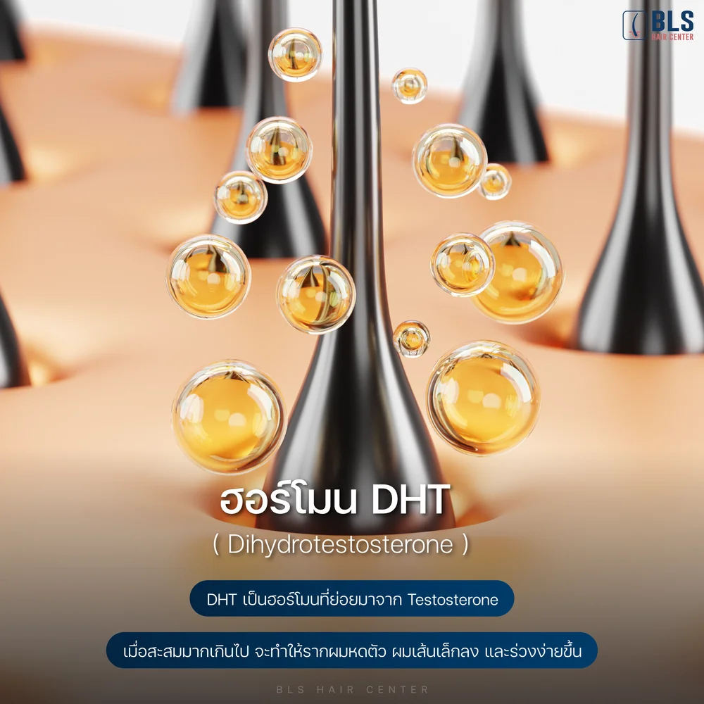 1วันผมร่วงกี่เส้น ฮอร์โมน DHT ทำให้ผมร่วงเยอะมาก จริงไหม?