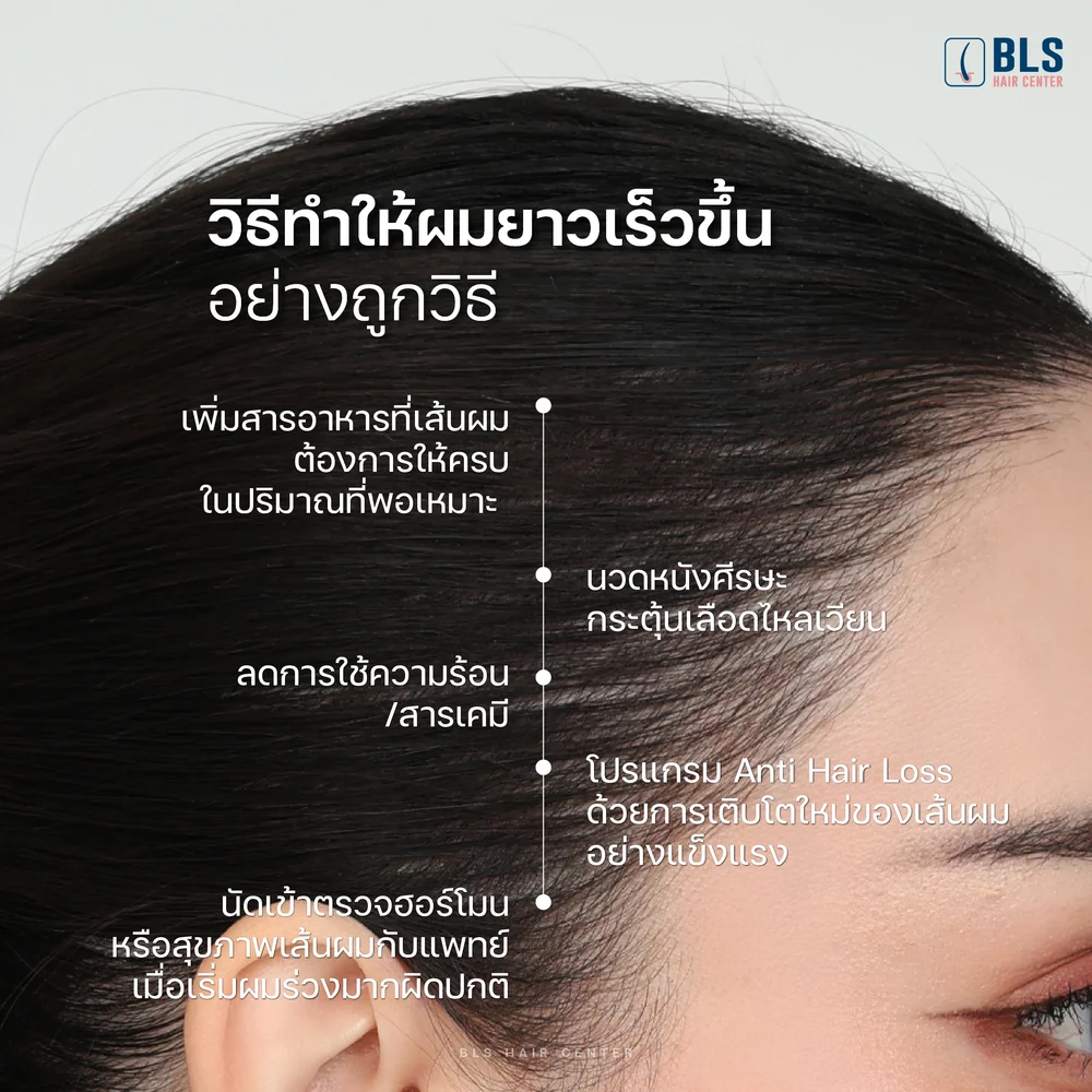 วิธีแก้ผมบาง ผมร่วงเยอะมาก