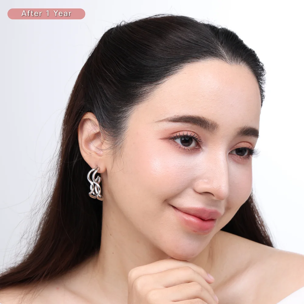 ผมบาง กลับมาหนา คลินิก ปลูกผม Hair Transplant Bangkok
