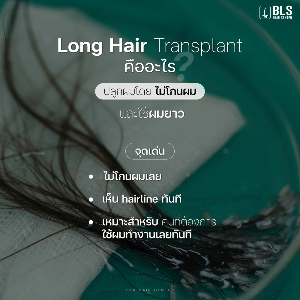 เปรียบเทียบเทคนิคปลูกผมสำหรับผู้หญิงในไทย ปลูกผมผู้หญิงที่ไหนดีใกล้ฉัน