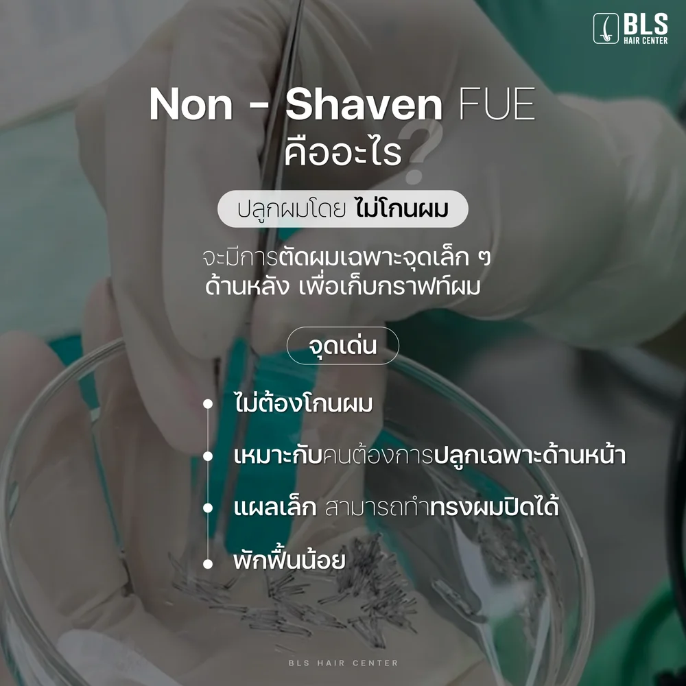 ปลูกผมผู้หญิงแบบไหนดีและปลอดภัย