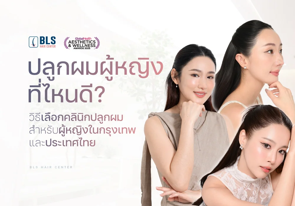 ปลูกผมผู้หญิง ที่ไหนดี? มีวิธีเลือกคลินิกปลูกผมสำหรับผู้หญิงในกรุงเทพและประเทศไทยอย่างไร?