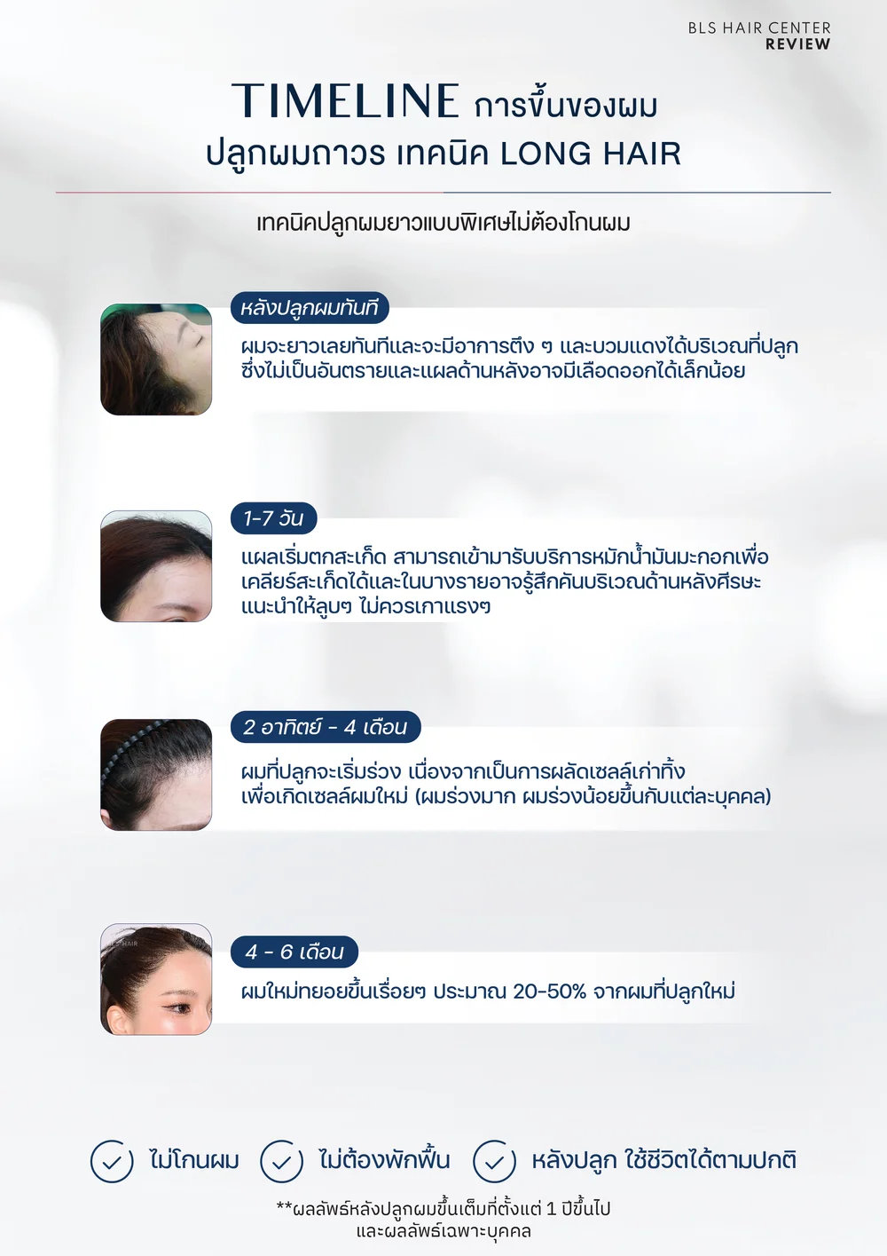 หมอบี ปลูกผม ใช้เทคนิคอะไร