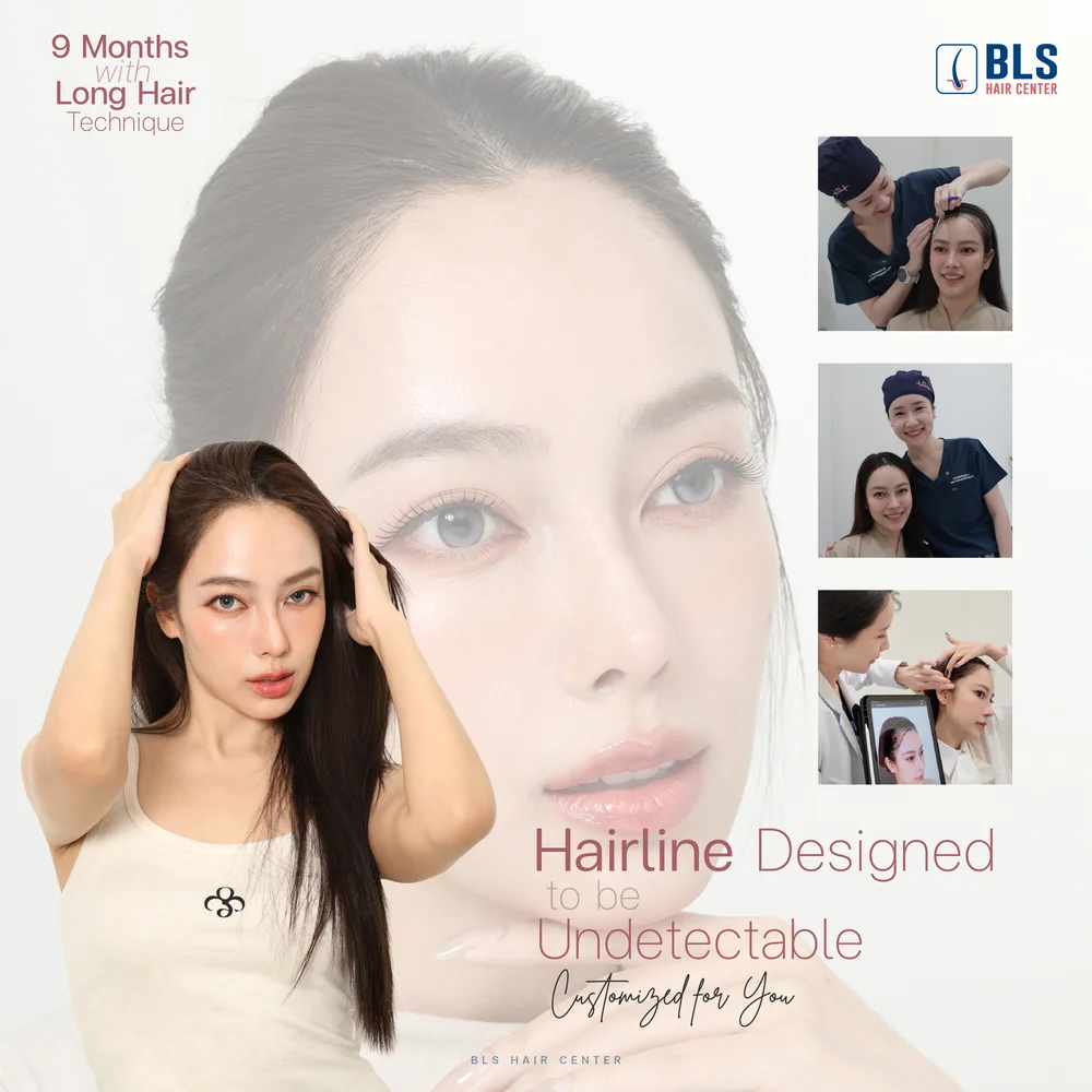 BLS ปลูกผม แนวไรผมเป็นธรรมชาติ