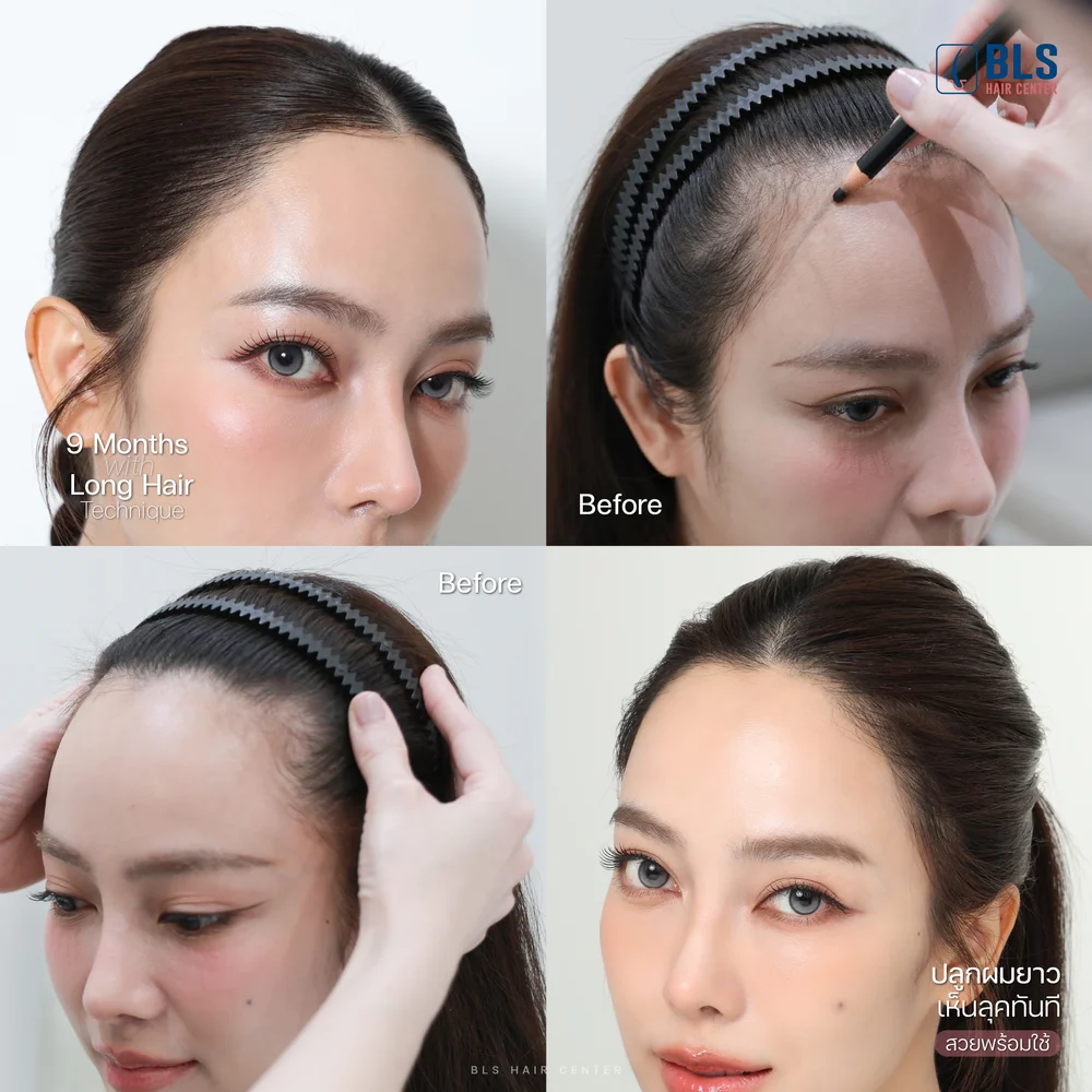 เทคนิค Long Hair ออกแบบแนวผมรับกรอบหน้า