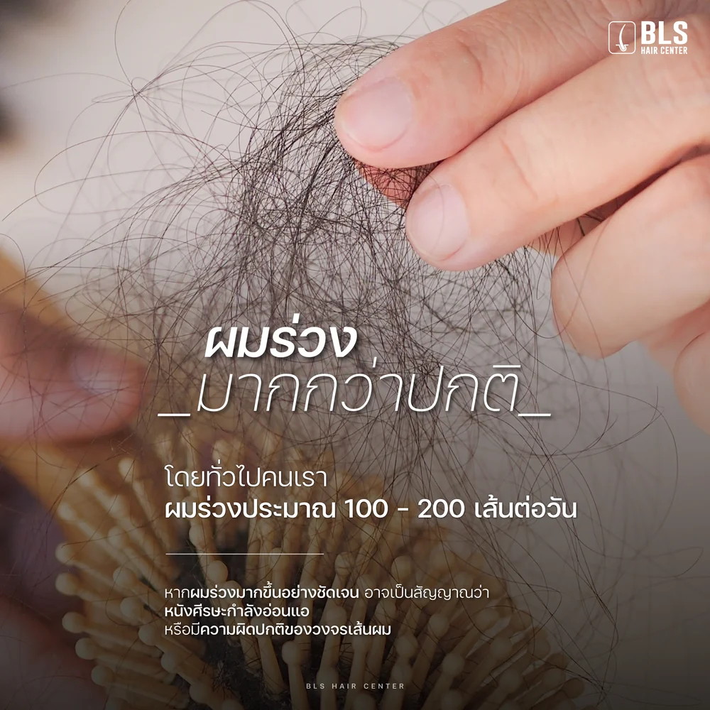 ผมร่วงเกิดจากอะไร? หัวล้านกรรมพันธุ์ มีส่วนหรือไม่?