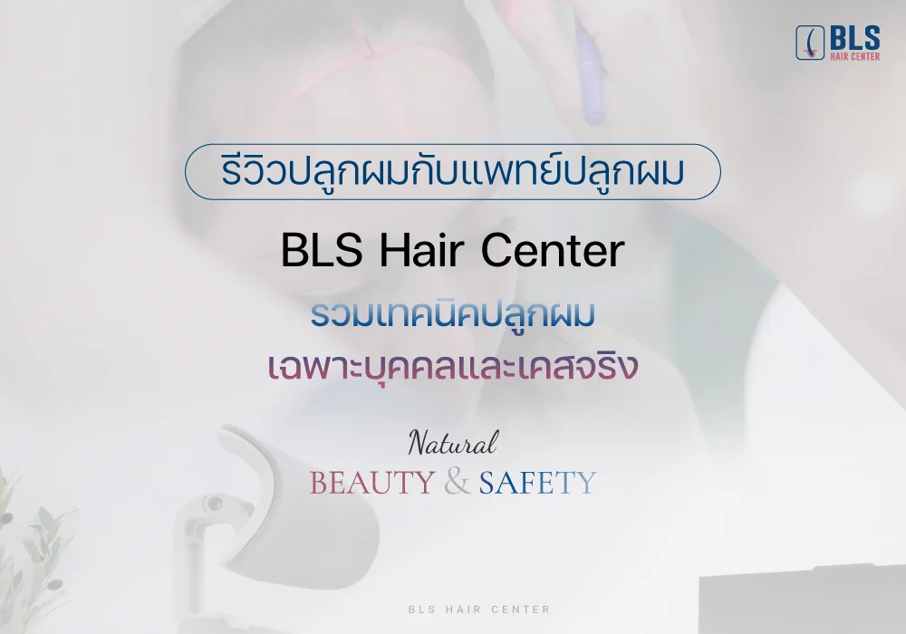 รีวิวปลูกผมกับแพทย์ปลูกผม BLS Hair Center รวมเทคนิคปลูกผมเฉพาะบุคคลและเคสจริง