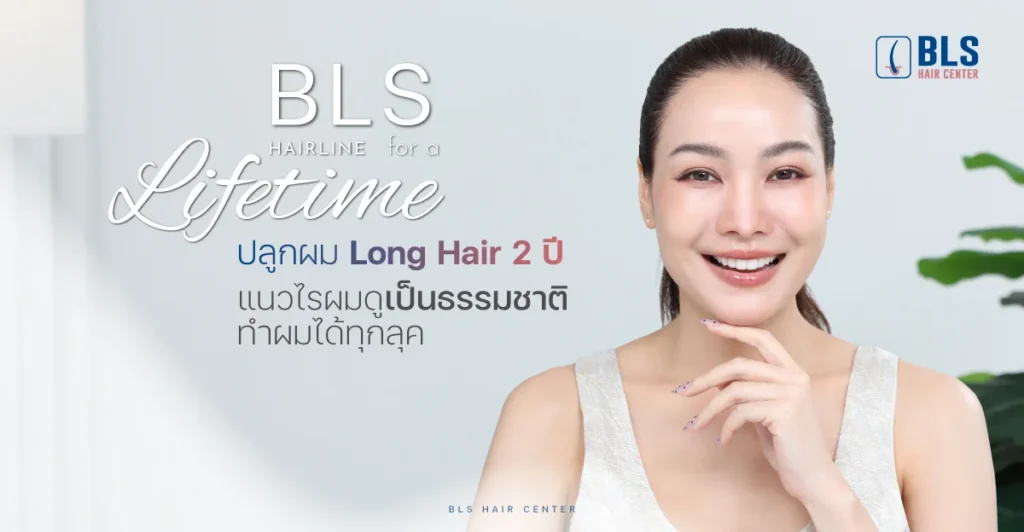 ปลูกผม Long Hair ผลลัพธ์ 2 ปี ไรผมเป็นธรรมชาติ ทำผมได้ทุกลุค