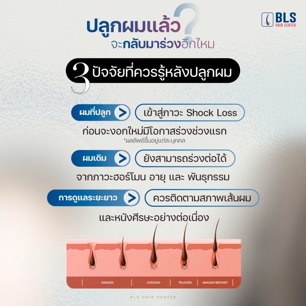 ปลูกผมแล้วจะกลับมาร่วงอีกไหม ปลูกผมแล้วทำไมผมถึงร่วง